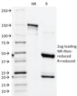 Prostatic Acid Phosphatase/ACPP Antibody (ACPP/1339), Novus Biologicals